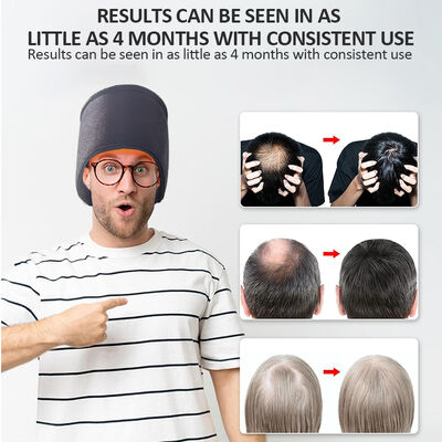 660nm шапочка для роста волос со светодиодной красной светотерапией и 270 светодиодами красного света и лазерной терапевтической шапочкой